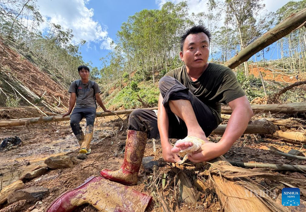 တရုတ်နိုင်ငံ တောင်ပိုင်း ကွမ်ရှီး (ကျွမ့်) ကိုယ်ပိုင်အုပ်ချုပ်ခွင့်ရဒေသ နန်နင်းမြို့၊ ဟိန်ကျိုးခရိုင်အဆင့်မြို့၊ ကျန့်လုန်မြို့နယ်တွင် ပွန်းပဲ့နေသောခြေထောက်အား ပတ်တီးဖြင့်စည်းနေသည့် လီဟိန်ဟောင် (ယာ) ကို
၂၀၂၆ ခုနှစ် ဇူလိုင် ၁၀ ရက်က တွေ့ရစဉ် (ဆင်ဟွာ)